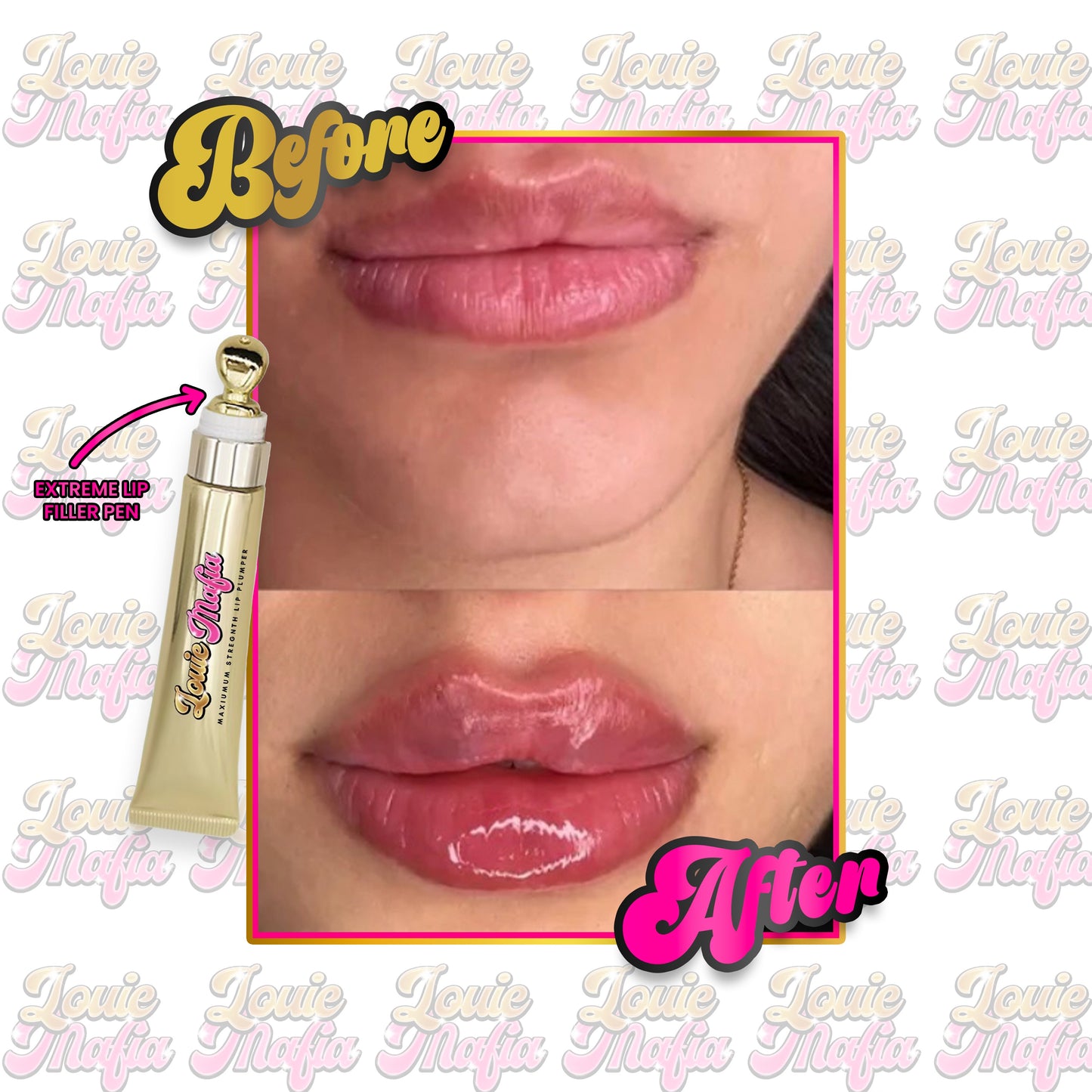 PRE-ORDER EXTREME LIP FILLER PEN